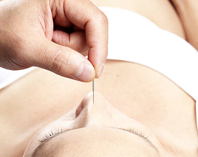 pregnant woman undergoing an acupuncture treatment
