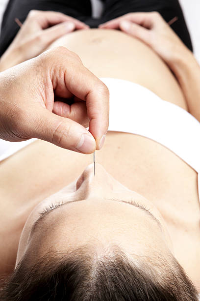 pregnant woman undergoing an acupuncture treatment