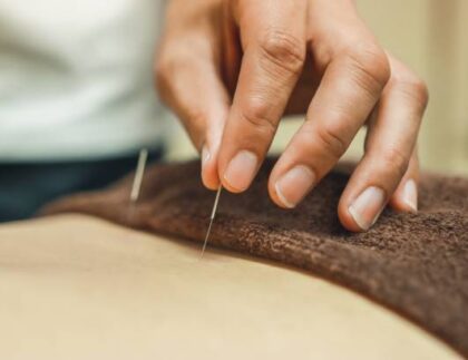 Acupuncture needles for woman's body
