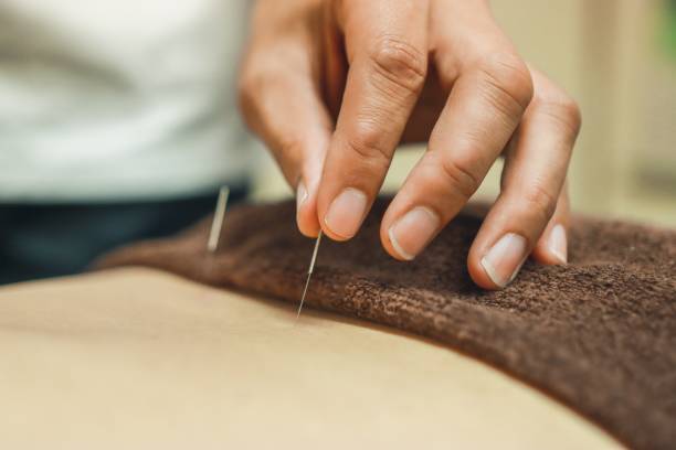 Acupuncture needles for woman's body