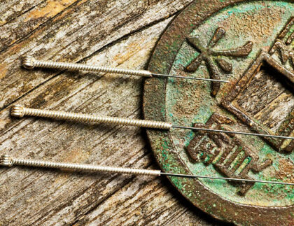 acupuncture needles with antique chinese coin